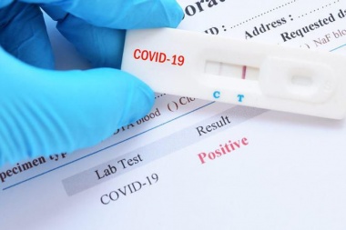 Detectaron 30 personas que tuvieron COVID-19 sin darse cuenta